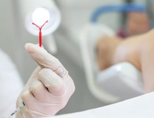 Goiás realiza mutirão de DIU para ampliar acesso ao planejamento reprodutivo