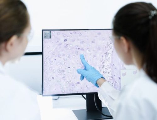 Anvisa aprova novo medicamento para linfoma não Hodgkin