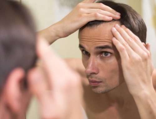Especialista alerta para aumento dos casos calvície entre jovens de 20 a 30 anos